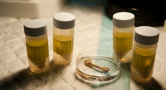 The bone takes a few months to grow inside a unique bioreactor.