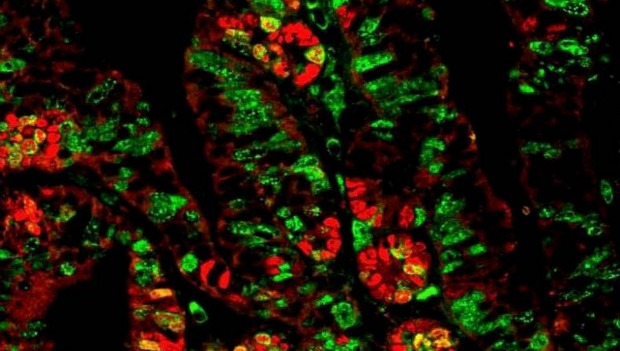 p53 Gene p53 can stop cancer cells from invading healthy tissue. Illustration by permission of the journal Nature.