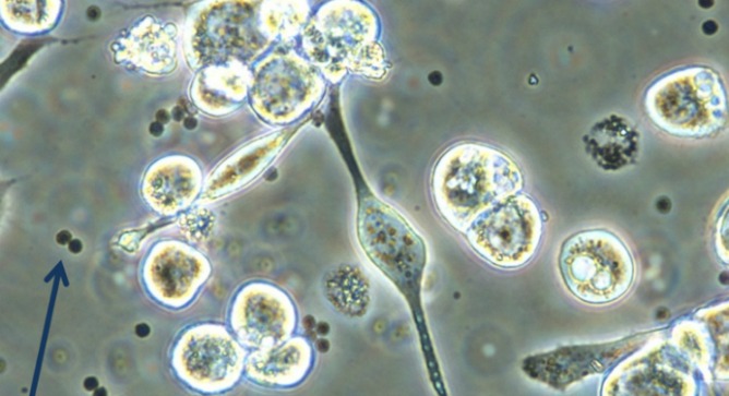 Virus-infected cells after treatment with Vecoy. Photo courtesy of Shmulik Ittah and Yaniv Amir