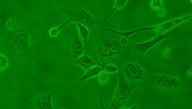 Lung cancer cells, following irradiation with millimeter waves, cannot reproduce.