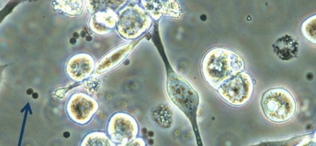 virus under microscope