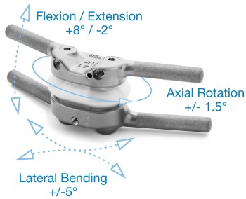 tops-device The TOPS implant allows for full range of normal back motion.