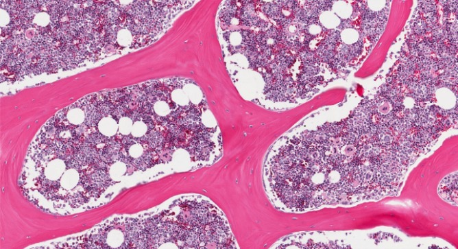 Bone marrow. Image via Shutterstock.com