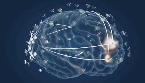 ElMindA’s device for diagnosing and monitoring brain disorders.