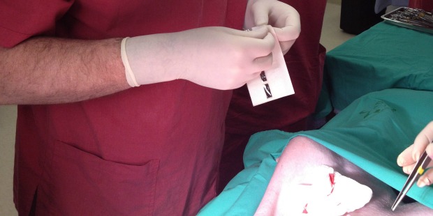 stitches The product provides a next-generation alternative to staples and stitches.