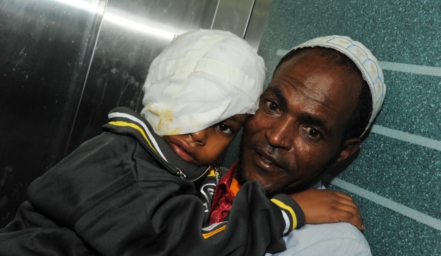 boy The boy will be hospitalized for about a month.