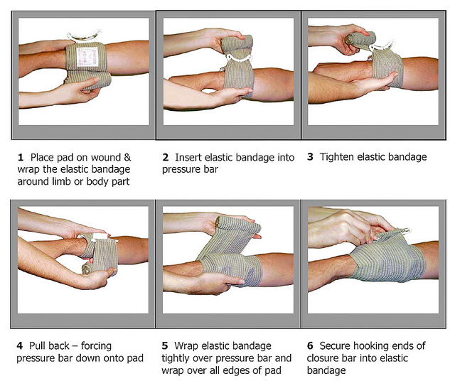 The Emergency Bandage stops bleeding.