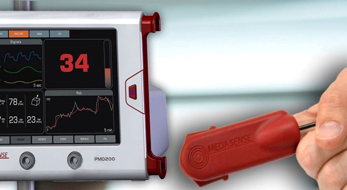 Medasense’s finger-mounted sensor records relevant physiological signs, and algorithms convert this data into a real-time, continuous pain index displayed on a bedside monitor. Photo courtesy Medasense’s finger-mounted sensor records relevant physiological signs, and algorithms convert this data into a real-time, continuous pain index displayed on a bedside monitor. Photo courtesy