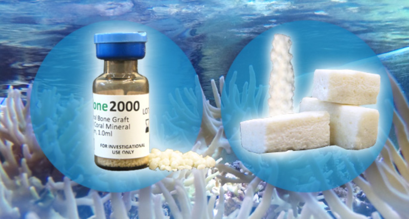 Image courtesy of CoreBone. Image courtesy of CoreBone.