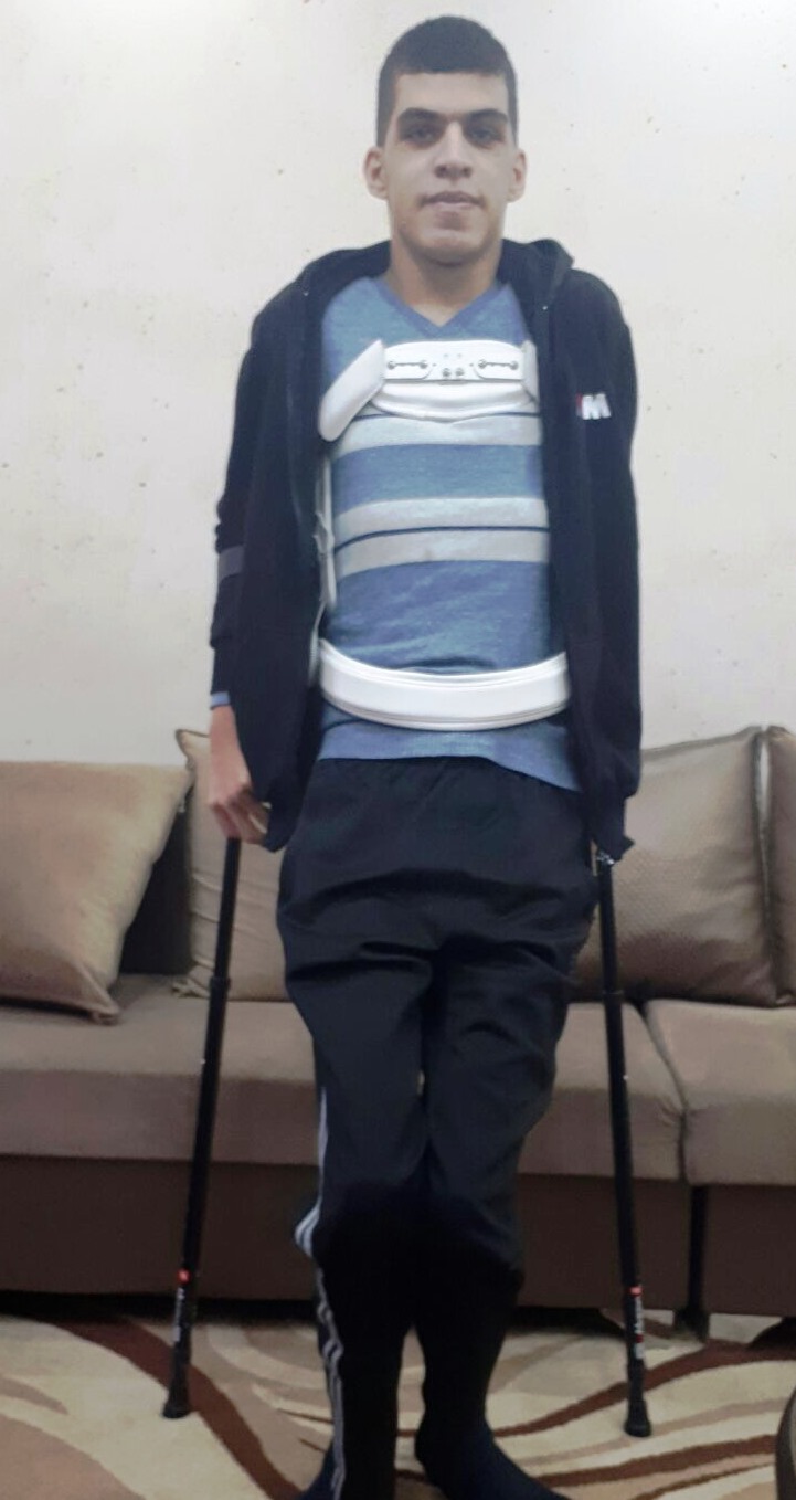 Yusef Rabaya back on his feet. Photo courtesy of Hadassah Medical Organization