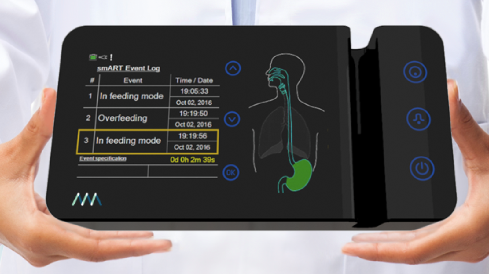 ART Medical’s advanced sensor-based feeding-tube solution enables automated and real-time intervention to avoid intubation-related medical complications. Photo: courtesy
