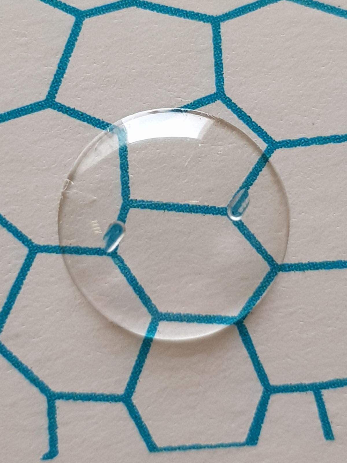 EndoArt is a revolutionary implant that will eliminate the need for human corneal implants. Photo courtesy of EyeYon