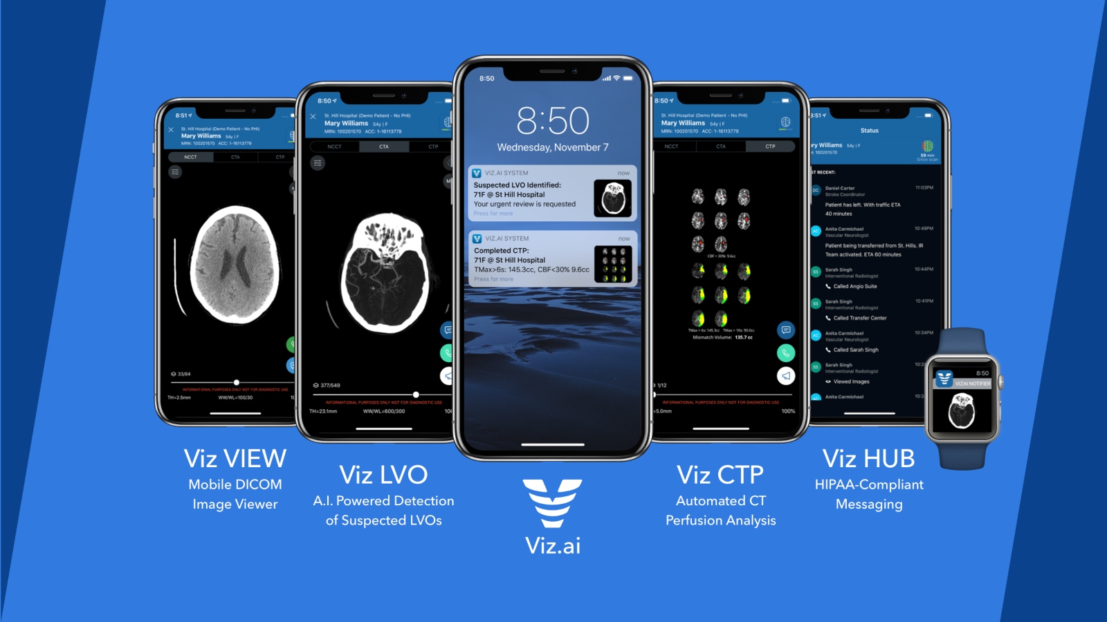 Viz.ai offers a technological solution for spotting large vessel occlusions and coordinating treatment quickly for stroke patients. Photo: courtesy
