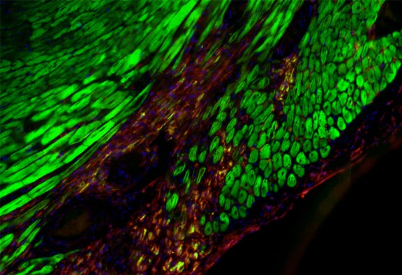 Injured heart following myocardial infarction. Healthy cardiomyocytes are stained in green. Injured area is stained in red. Image courtesy of Weizmann Institute
