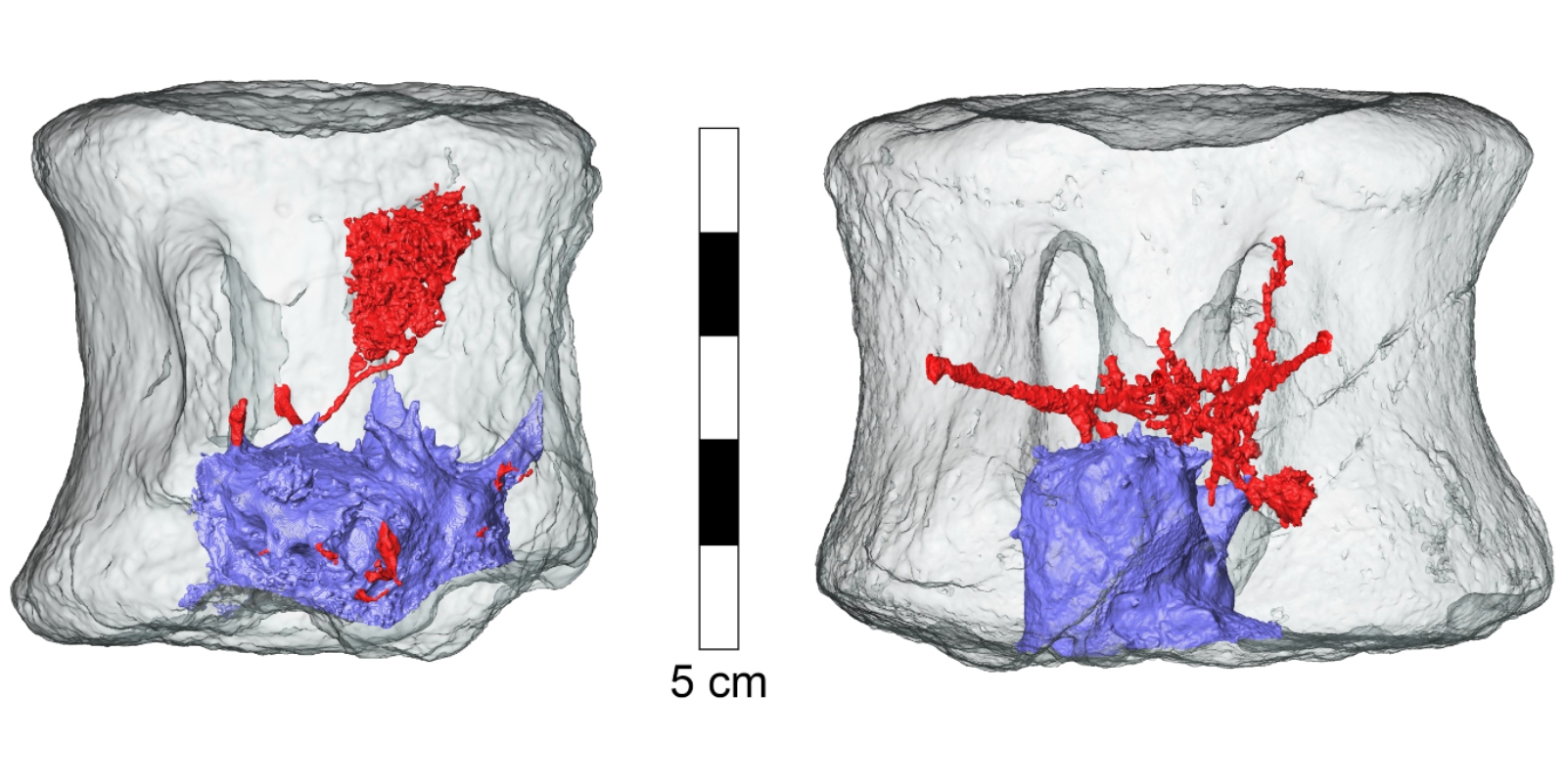 Three-dimensional reconstruction of the mesh surface of the tumors and associated blood vessels in the hadrosaur vertebrae. Image courtesy of Ariel Pokhojaev/Sackler Faculty of Medicine, Tel-Aviv University