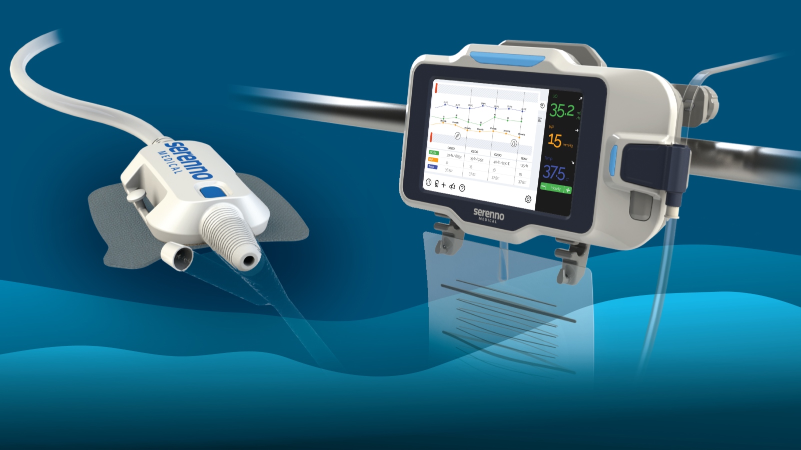 Serenno's monitoring device allows ICU staff to measure urine output without going to the bedside. Photo: courtesy