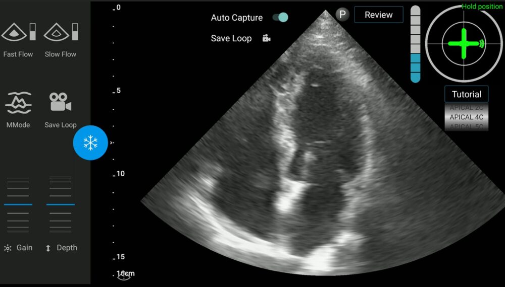 Image courtesy of UltraSight