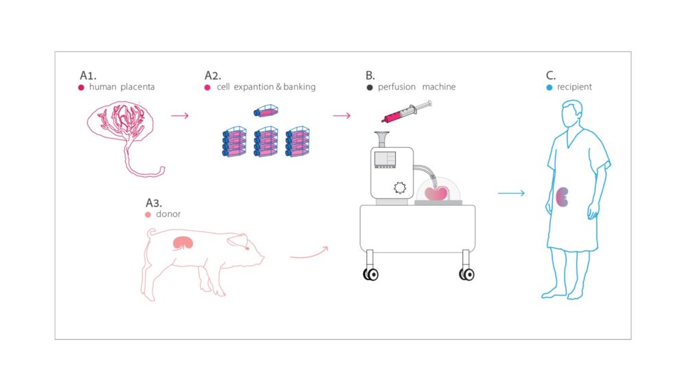 Illustration by Noa First Cohen from Cohen at al. Scientific Reports 11, 13437 (2021).