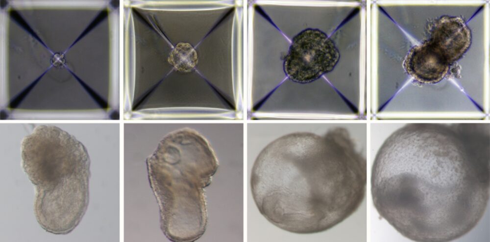 Development of synthetic embryo models from Day 1 (top left) to Day 8 (bottom right). All their early organ progenitors had formed, including a beating heart, an emerging blood circulation, a brain, a neural tube and an intestinal tract. Photo courtesy of Weizmann Institute