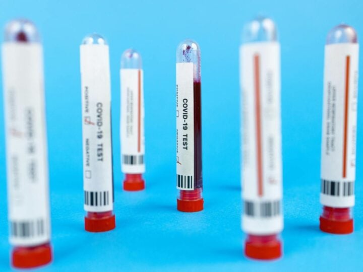 There’s a lot to be gleaned from liquid biopsy of blood and other body fluids. Photo by Maksim Goncharenok/Pexels