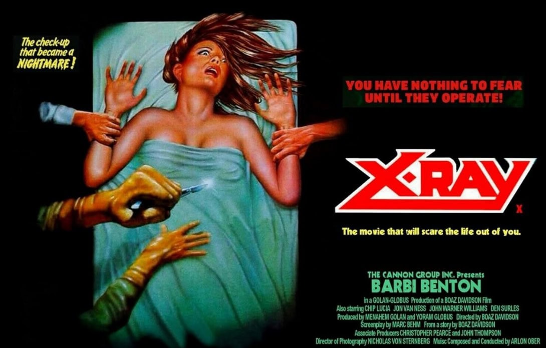 A movie poster featuring a frightened woman lies on an operating table, reaching upward, as gloved hands move toward her. The text reads, The checkup that became a NIGHTMARE! YOU HAVE NOTHING TO FEAR UNTIL THEY OPERATE! X-RAY.
