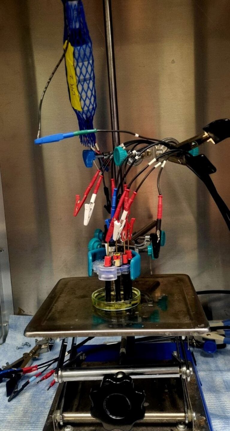 Sensor apparatus at Prof. Hadar Ben-Yoav’s Ben-Gurion University lab. Photo by Yulia Karra