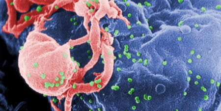 HIV budding